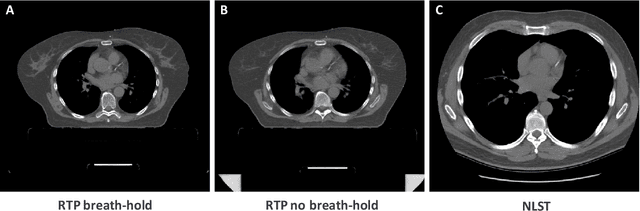 Figure 3 for Generative Models for Reproducible Coronary Calcium Scoring