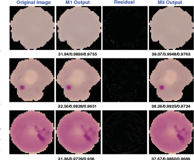 Figure 2 for Lossy Medical Image Compression using Residual Learning-based Dual Autoencoder Model