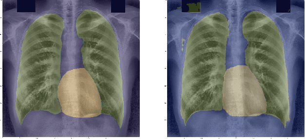 Figure 4 for Chest X-ray lung and heart segmentation based on minimal training sets