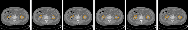 Figure 1 for Neural ODEs for Image Segmentation with Level Sets