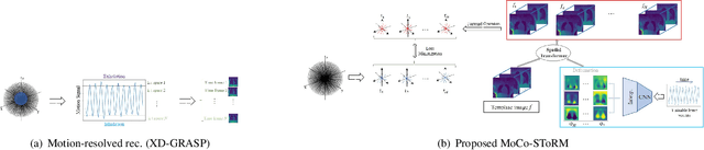 Figure 1 for Dynamic imaging using motion-compensated smoothness regularization on manifolds (MoCo-SToRM)