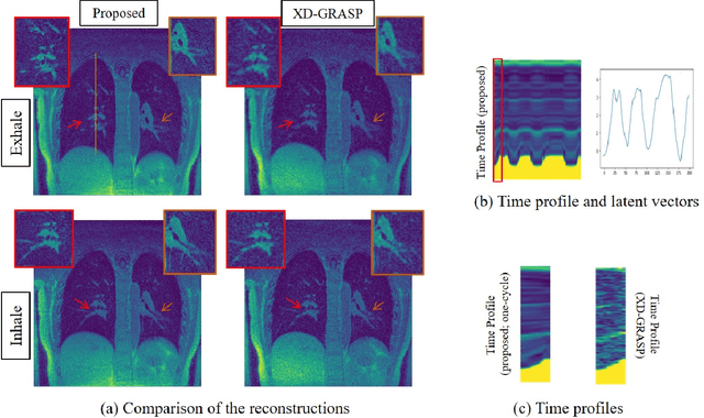 Figure 3 for Dynamic imaging using Motion-Compensated SmooThness Regularization on Manifolds (MoCo-SToRM)
