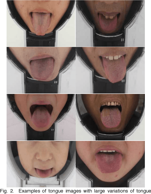 Figure 2 for Boundary Guidance Hierarchical Network for Real-Time Tongue Segmentation