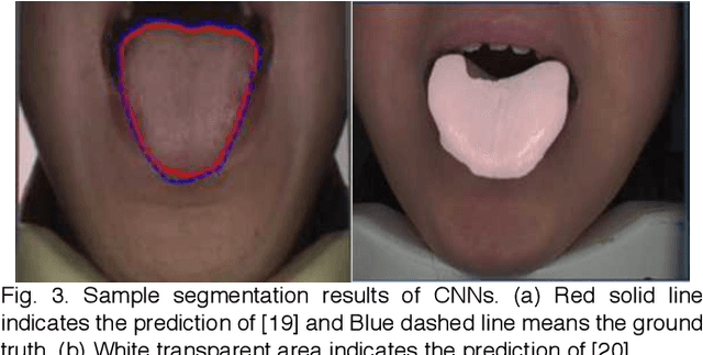Figure 3 for Boundary Guidance Hierarchical Network for Real-Time Tongue Segmentation