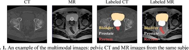 Figure 1 for Deep Learning based Inter-Modality Image Registration Supervised by Intra-Modality Similarity