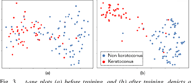 Figure 3 for Keratoconus Classifier for Smartphone-based Corneal Topographer