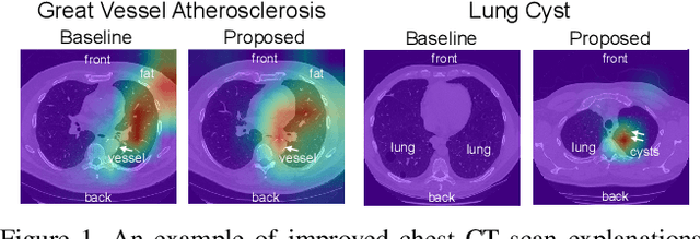 Figure 1 for HiResCAM: Explainable Multi-Organ Multi-Abnormality Prediction in 3D Medical Images