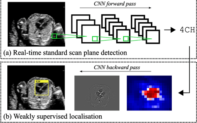 Figure 1 for SonoNet: Real-Time Detection and Localisation of Fetal Standard Scan Planes in Freehand Ultrasound
