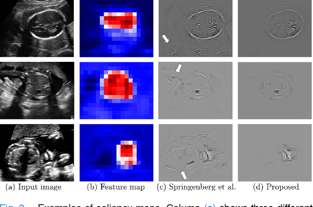 Figure 3 for SonoNet: Real-Time Detection and Localisation of Fetal Standard Scan Planes in Freehand Ultrasound