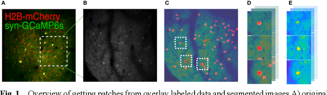 Figure 1 for Automated identification of neural cells in the multi-photon images using deep-neural networks