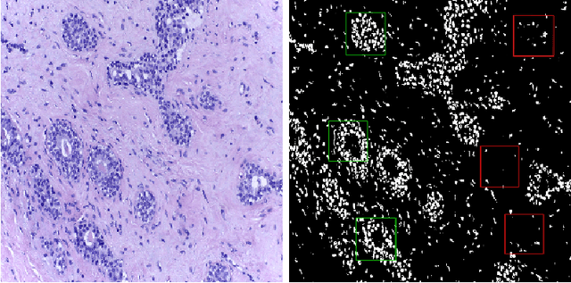 Figure 3 for Classification of Breast Cancer Histology using Deep Learning