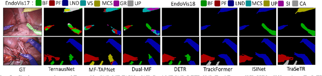 Figure 3 for TraSeTR: Track-to-Segment Transformer with Contrastive Query for Instance-level Instrument Segmentation in Robotic Surgery