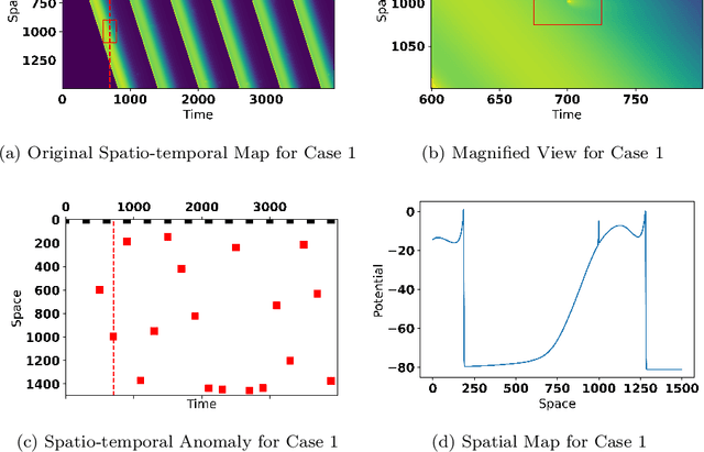 Figure 1 for Deep Spatio-temporal Sparse Decomposition for Trend Prediction and Anomaly Detection in Cardiac Electrical Conduction
