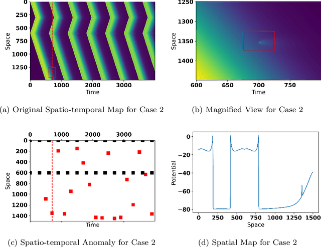 Figure 3 for Deep Spatio-temporal Sparse Decomposition for Trend Prediction and Anomaly Detection in Cardiac Electrical Conduction
