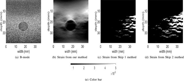 Figure 3 for Automatic Frame Selection using CNN in Ultrasound Elastography