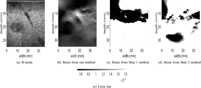 Figure 4 for Automatic Frame Selection using CNN in Ultrasound Elastography
