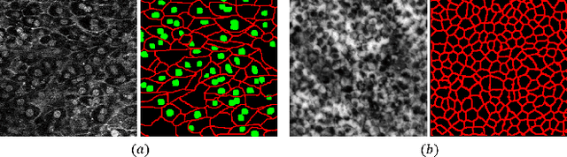 Figure 4 for Automatic Preprocessing and Ensemble Learning for Low Quality Cell Image Segmentation