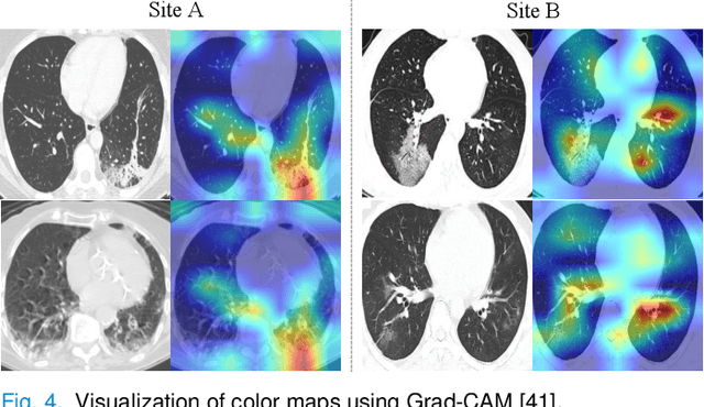 Figure 4 for Contrastive Cross-site Learning with Redesigned Net for COVID-19 CT Classification