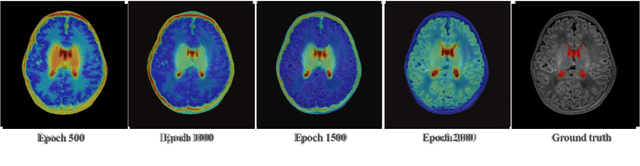 Figure 4 for A sparse annotation strategy based on attention-guided active learning for 3D medical image segmentation