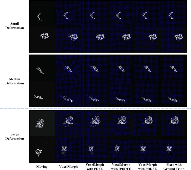 Figure 4 for Unsupervised Deformable Medical Image Registration via Pyramidal Residual Deformation Fields Estimation