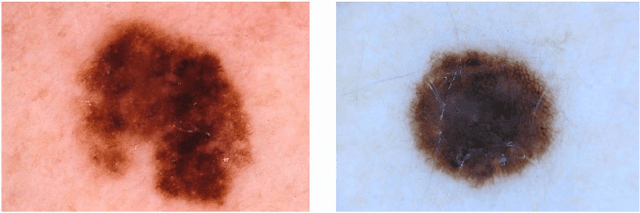 Figure 1 for Multi-task Learning with Crowdsourced Features Improves Skin Lesion Diagnosis