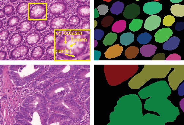 Figure 1 for DCAN: Deep Contour-Aware Networks for Accurate Gland Segmentation