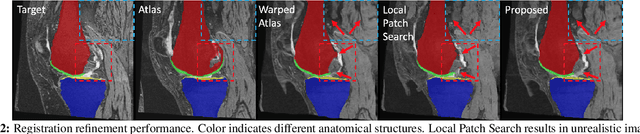 Figure 3 for VoteNet++: Registration Refinement for Multi-Atlas Segmentation