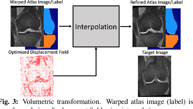 Figure 4 for VoteNet++: Registration Refinement for Multi-Atlas Segmentation