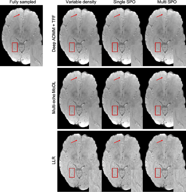 Figure 4 for Temporal Feature Fusion with Sampling Pattern Optimization for Multi-echo Gradient Echo Acquisition and Image Reconstruction