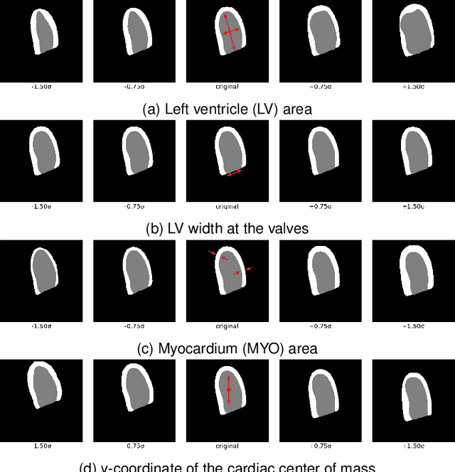 Figure 3 for Echocardiography Segmentation with Enforced Temporal Consistency