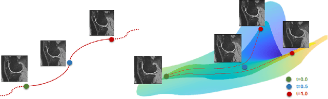 Figure 1 for Anatomical Data Augmentation via Fluid-based Image Registration
