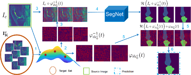 Figure 3 for Anatomical Data Augmentation via Fluid-based Image Registration