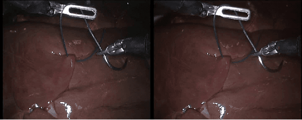 Figure 1 for Stereo Endoscopic Image Super-Resolution Using Disparity-Constrained Parallel Attention