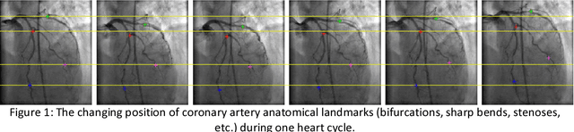 Figure 1 for Deep Neural Networks for ECG-free Cardiac Phase and End-Diastolic Frame Detection on Coronary Angiographies