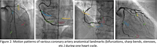 Figure 3 for Deep Neural Networks for ECG-free Cardiac Phase and End-Diastolic Frame Detection on Coronary Angiographies