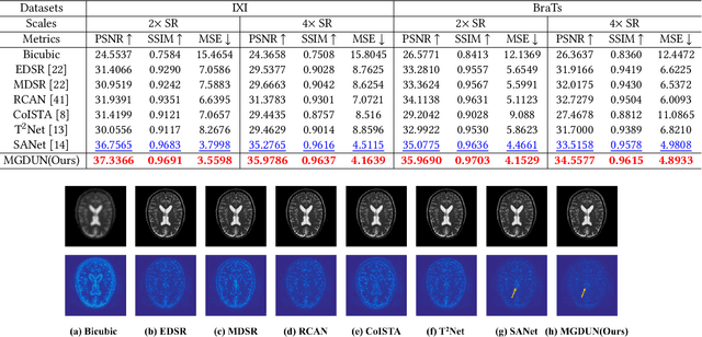 Figure 2 for Model-Guided Multi-Contrast Deep Unfolding Network for MRI Super-resolution Reconstruction