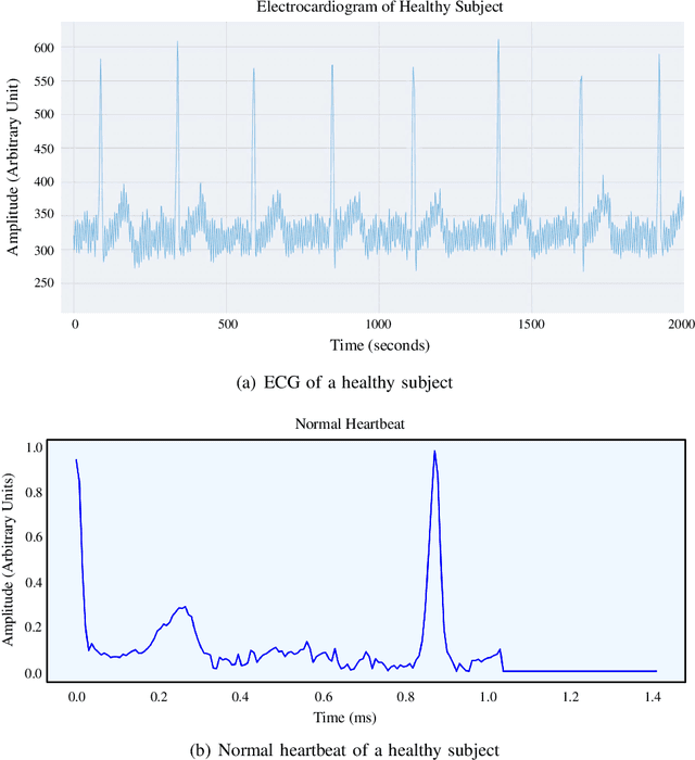 Figure 2 for MyWear: A Smart Wear for Continuous Body Vital Monitoring and Emergency Alert