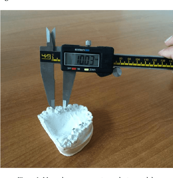 Figure 1 for Automatic Recognition of Landmarks on Digital Dental Models