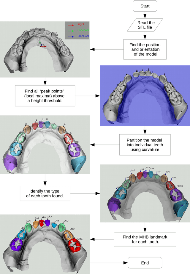 Figure 3 for Automatic Recognition of Landmarks on Digital Dental Models