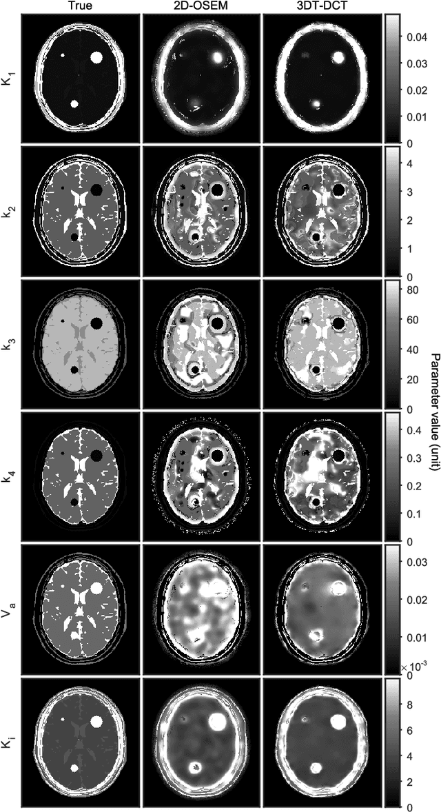 Figure 4 for Dynamic PET cardiac and parametric image reconstruction: a fixed-point proximity gradient approach using patch-based DCT and tensor SVD regularization