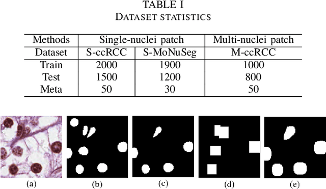 Figure 4 for Meta Mask Correction for Nuclei Segmentation in Histopathological Image