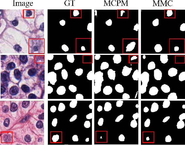 Figure 3 for Meta Mask Correction for Nuclei Segmentation in Histopathological Image