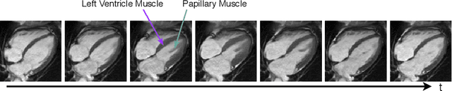 Figure 1 for Anatomy-Aware Cardiac Motion Estimation