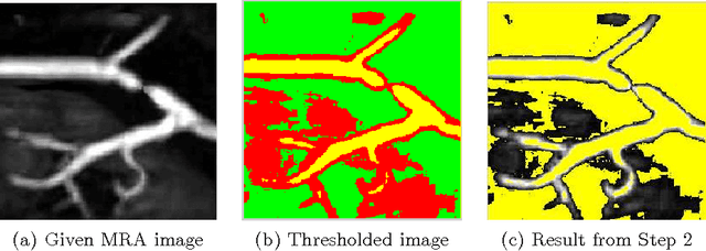 Figure 1 for Vessel Segmentation in Medical Imaging Using a Tight-Frame Based Algorithm