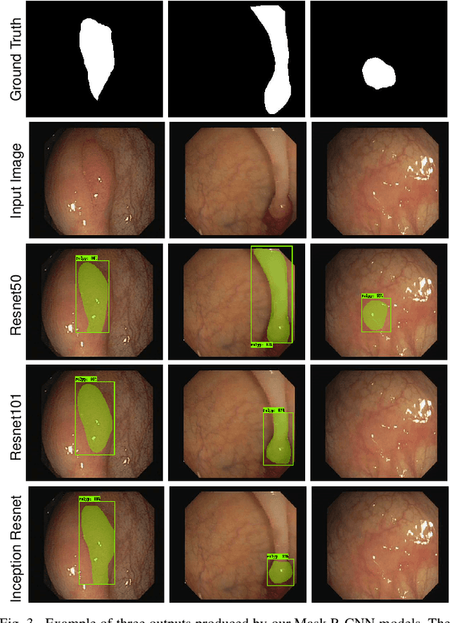 Figure 3 for Polyp Detection and Segmentation using Mask R-CNN: Does a Deeper Feature Extractor CNN Always Perform Better?