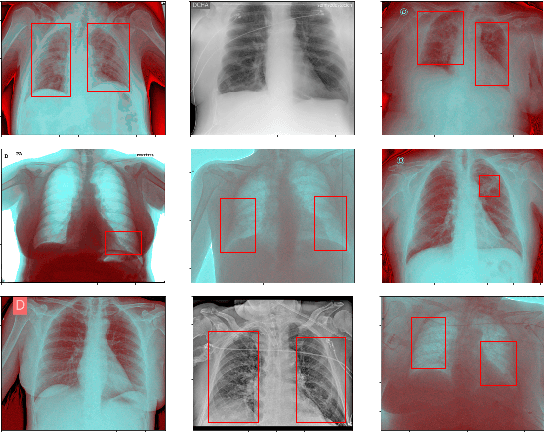 Figure 2 for CoV-TI-Net: Transferred Initialization with Modified End Layer for COVID-19 Diagnosis
