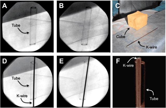 Figure 2 for Spatiotemporal-Aware Augmented Reality: Redefining HCI in Image-Guided Therapy