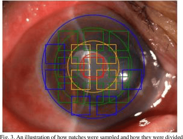Figure 3 for Deep Sequential Feature Learning in Clinical Image Classification of Infectious Keratitis