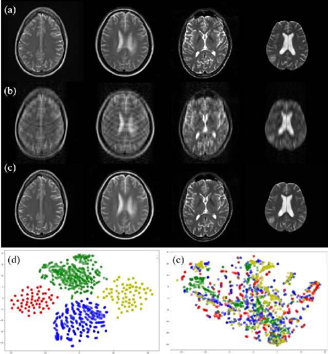 Figure 1 for Multi-institutional Collaborations for Improving Deep Learning-based Magnetic Resonance Image Reconstruction Using Federated Learning