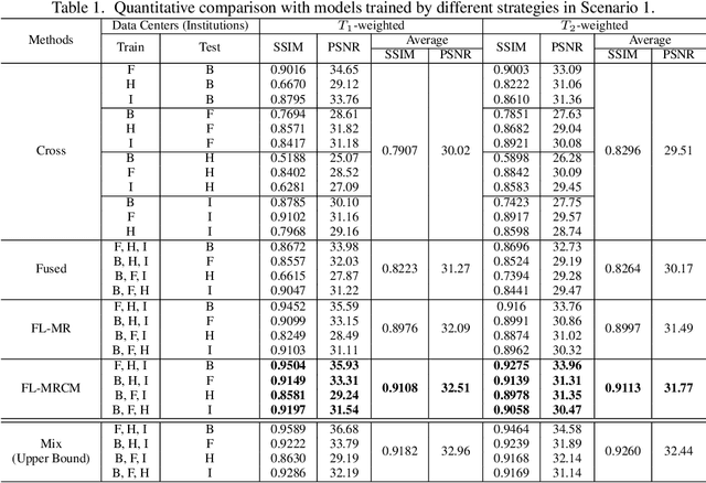 Figure 2 for Multi-institutional Collaborations for Improving Deep Learning-based Magnetic Resonance Image Reconstruction Using Federated Learning